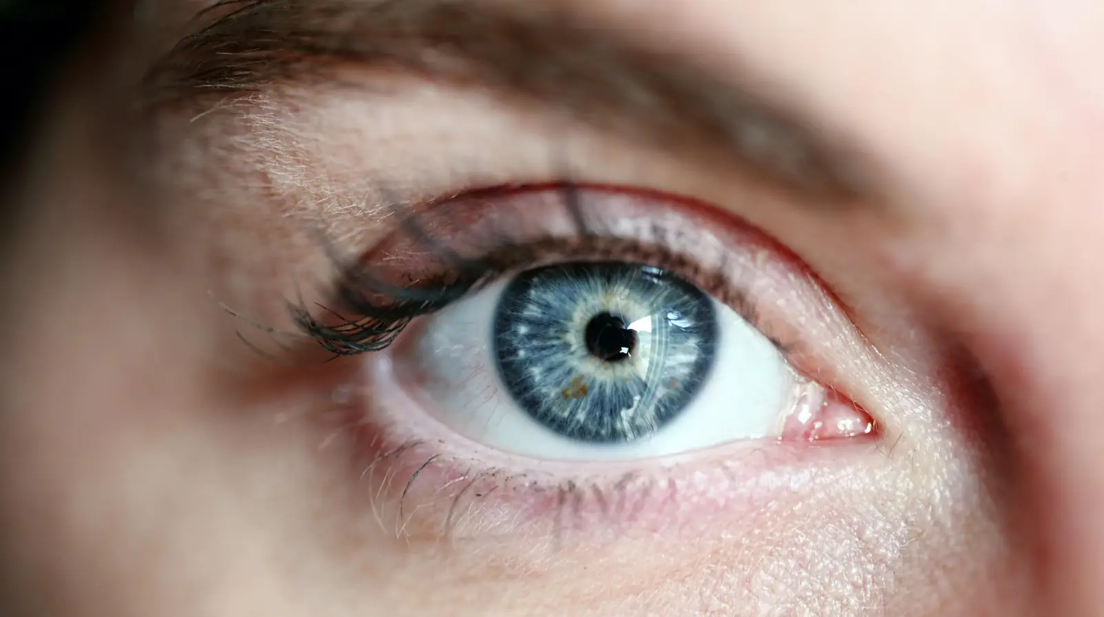 Gros plan sur un oeil au bord de paupiere inferieure rouge et irrite